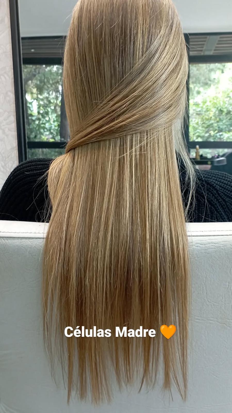 Tratamiento celulas madre